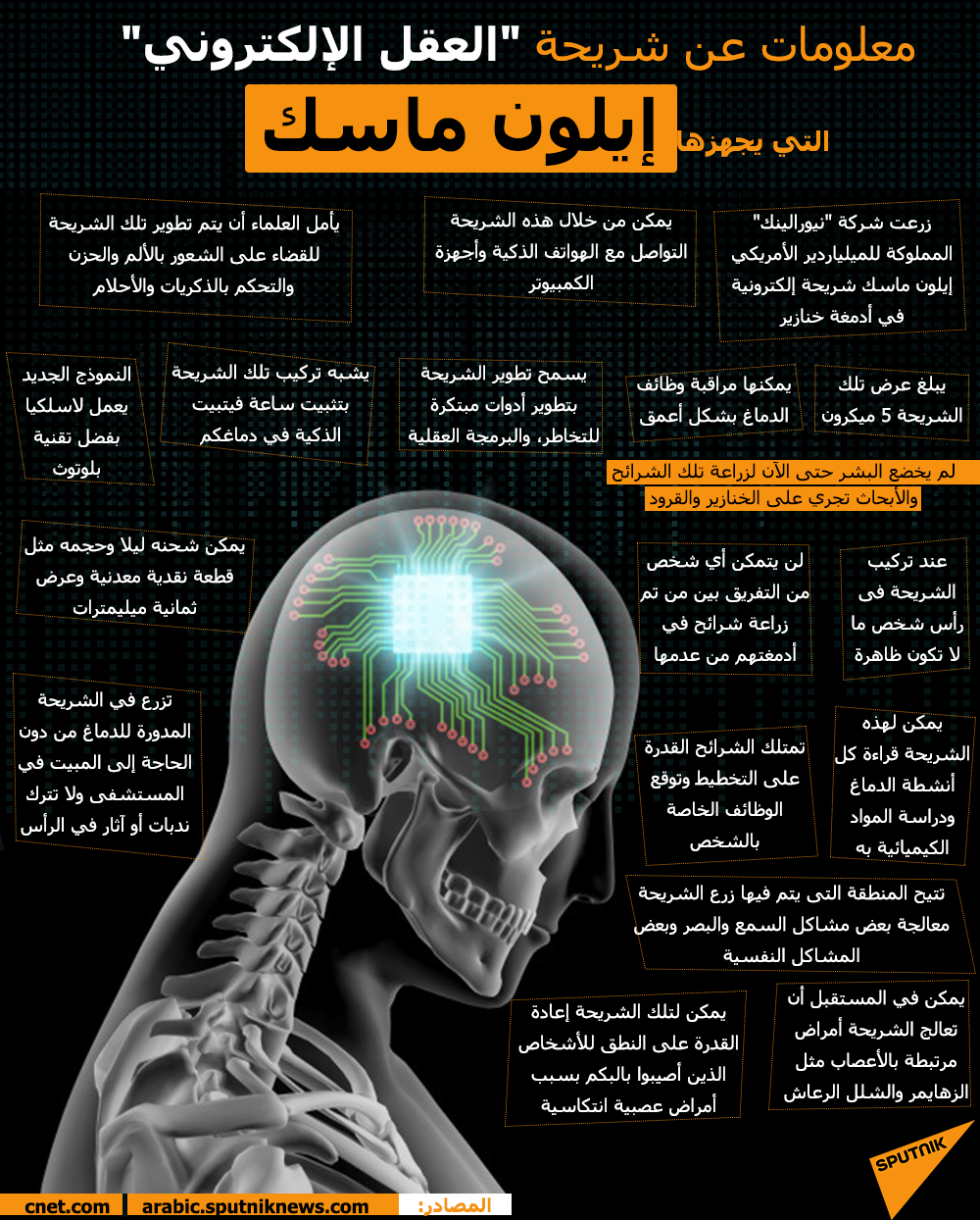 معلومات عن شريحة العقل الإلكتروني التي يجهزها إيلون ماسك - سبوتنيك عربي