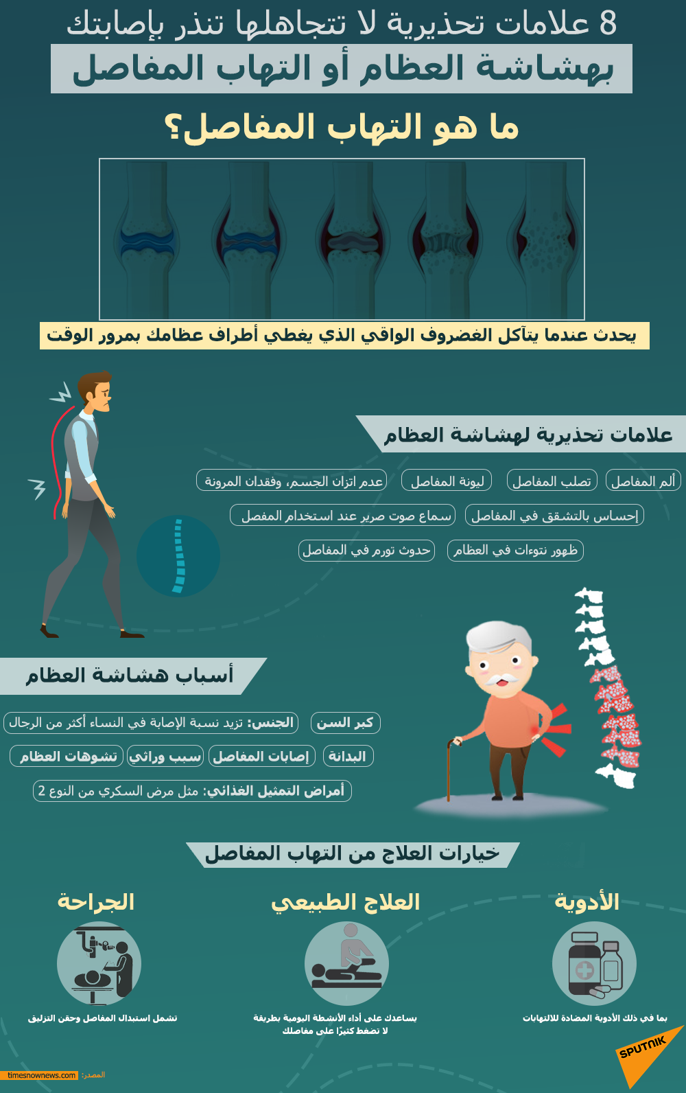 علامات التهاب المفاصل وهشاشة العظام - سبوتنيك عربي