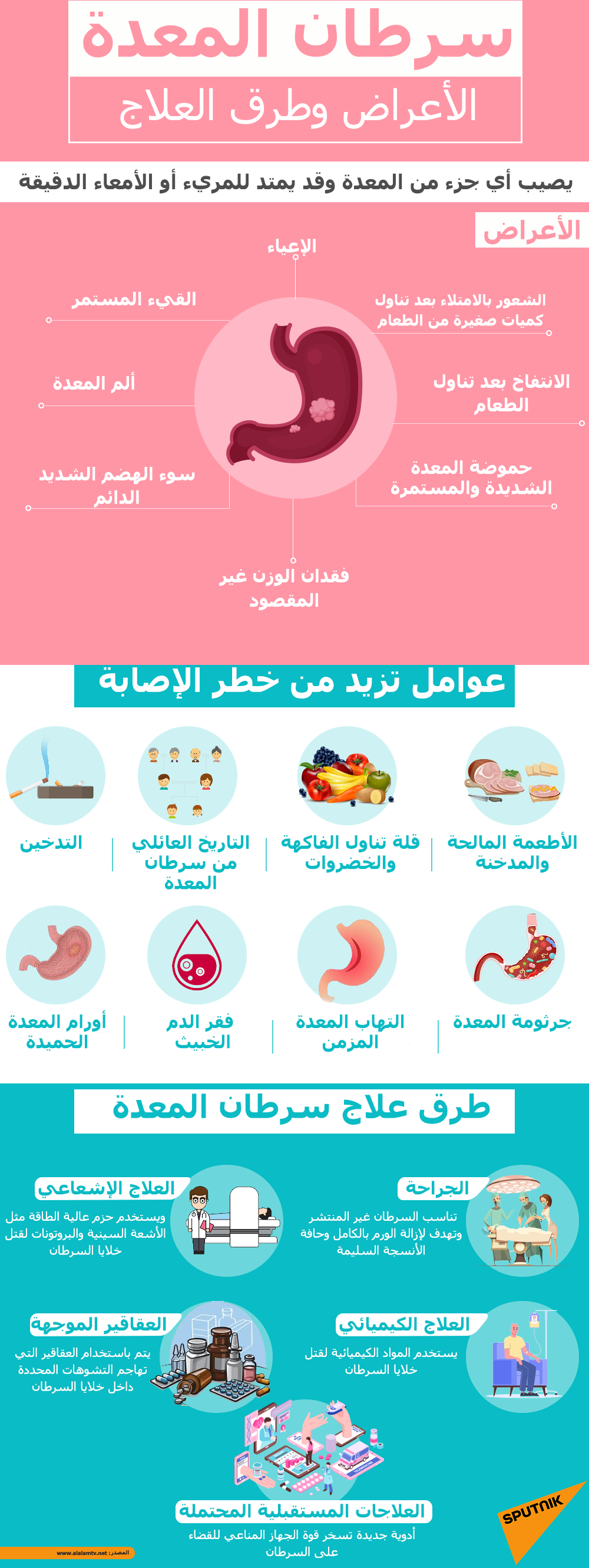 سرطان المعدة... الأعراض وطرق العلاج - سبوتنيك عربي