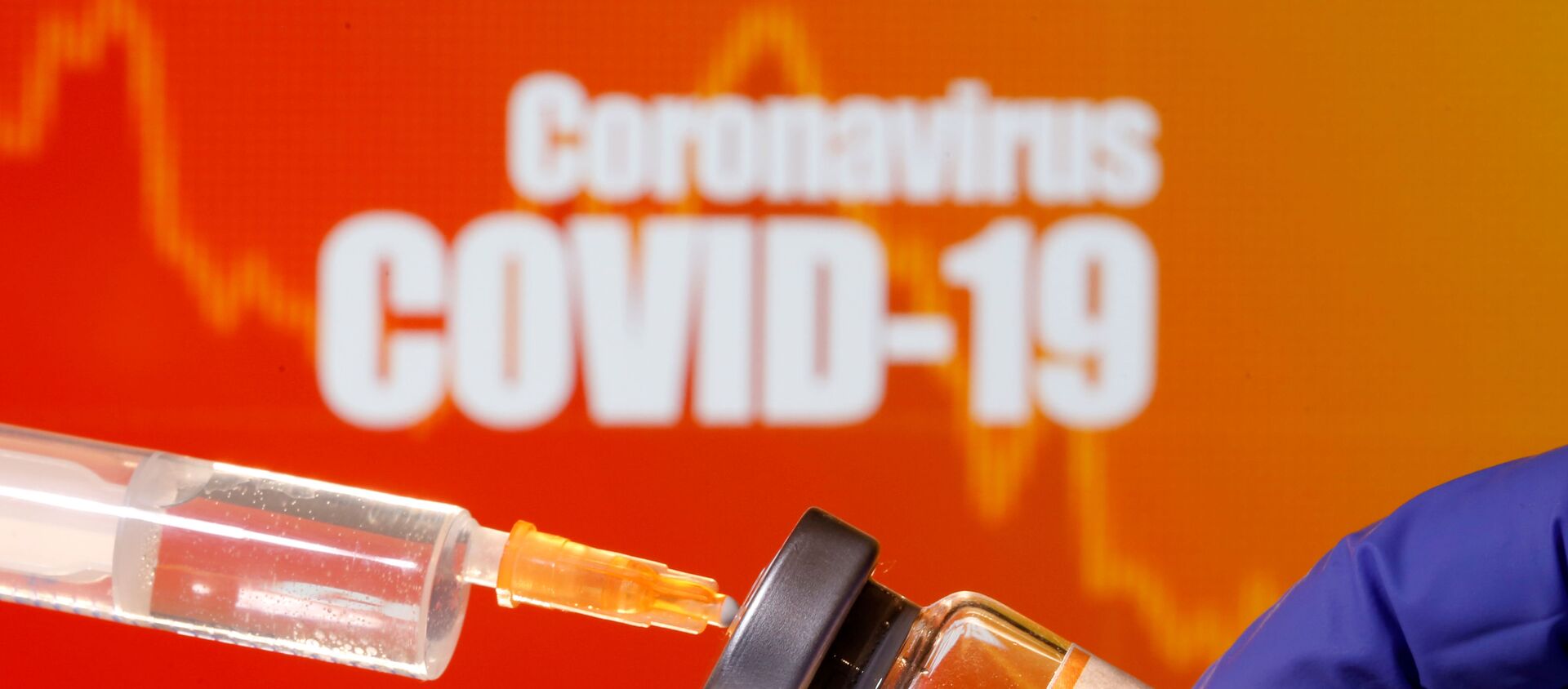 اختبارات - لقاح مضاد فيروس كورونا، يوليو 2020 - سبوتنيك عربي, 1920, 22.05.2021