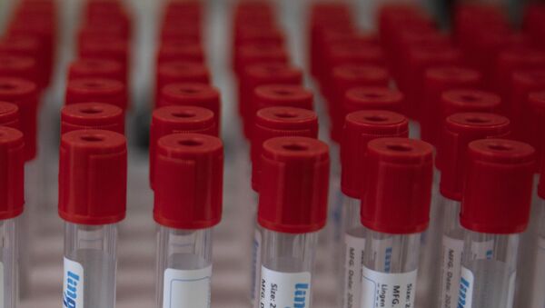 اختبارات - لقاح مضاد فيروس كورونا، مايو 2020 - سبوتنيك عربي