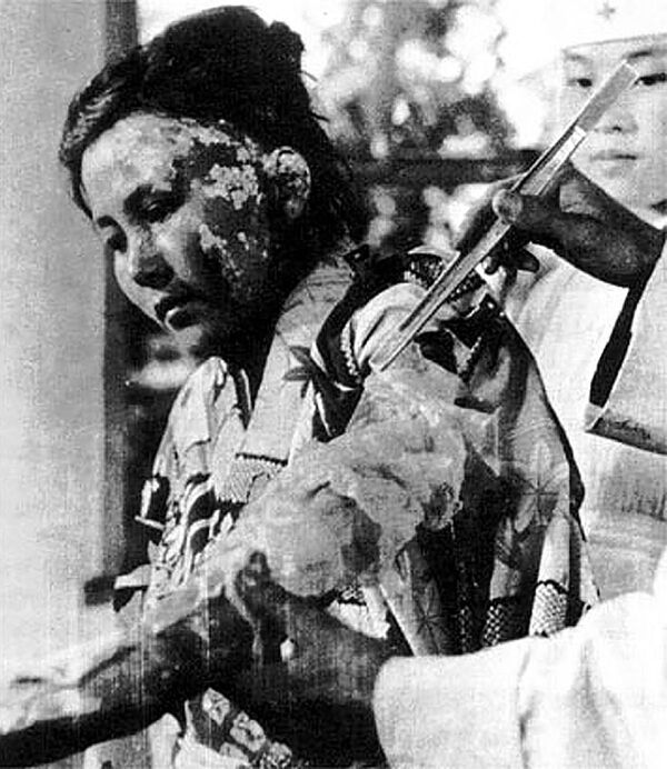الفتاة تويوكو كوجاتا، 22 عاما، ضحية الانفجار الذري تتلقى العلاج في مستشفى هيروشيما للصليب الأحمر، 6 أكتوبر/ تشرين الأول 1945 - سبوتنيك عربي