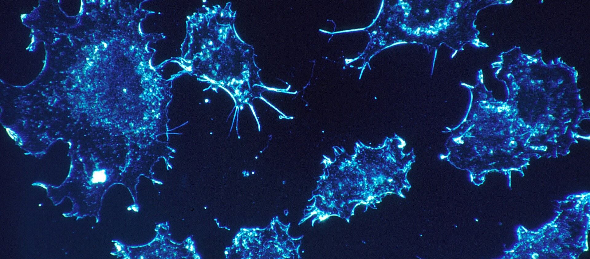 خلايا سرطانية - سبوتنيك عربي, 1920, 25.03.2021