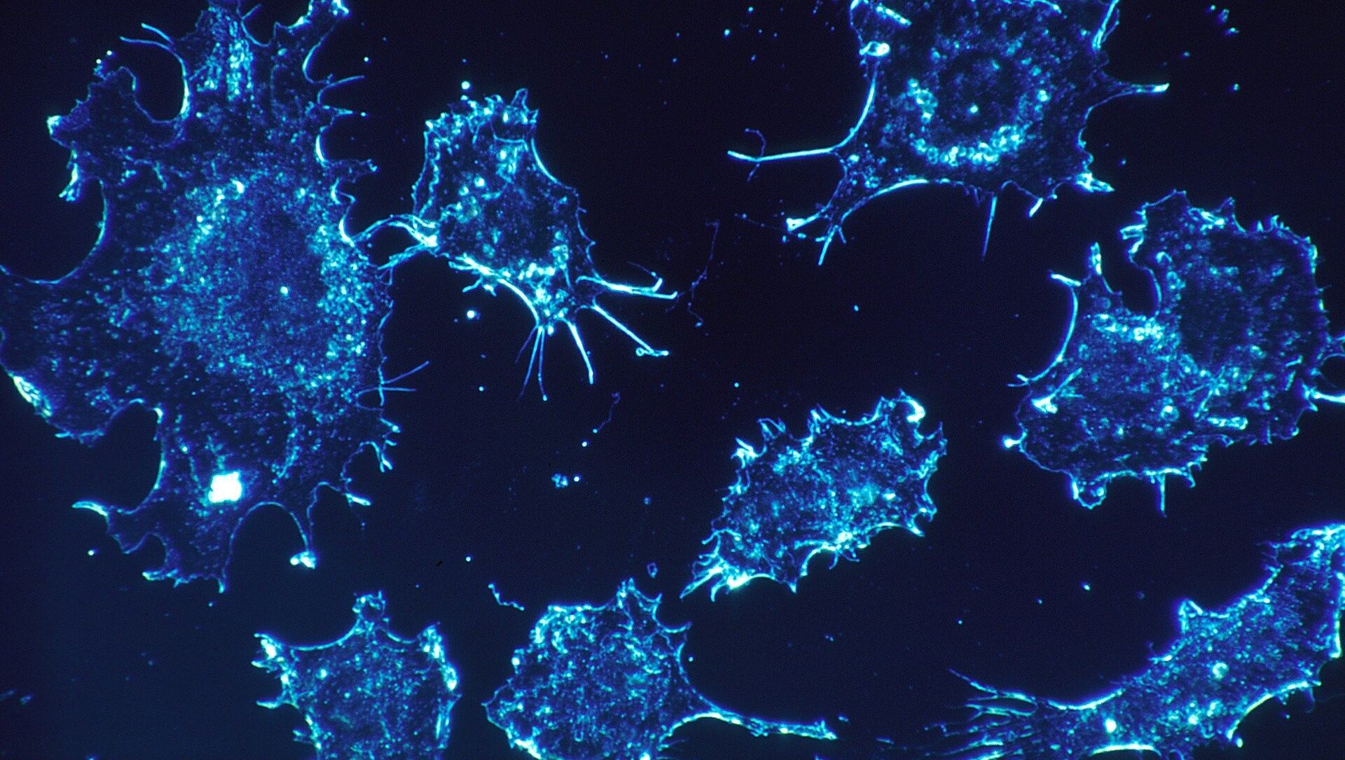 خلايا سرطانية - سبوتنيك عربي, 1920, 25.03.2021