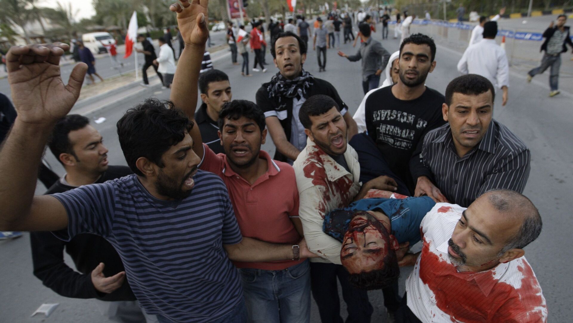 نقل أحد المصابين خلال مظاهرة مناهضة للحكومة البحرينية إلى سيارة ليتم نقله إلى المستشفى في المنامة، البحرين، 18 فبراير 2011 - سبوتنيك عربي, 1920, 14.02.2021
