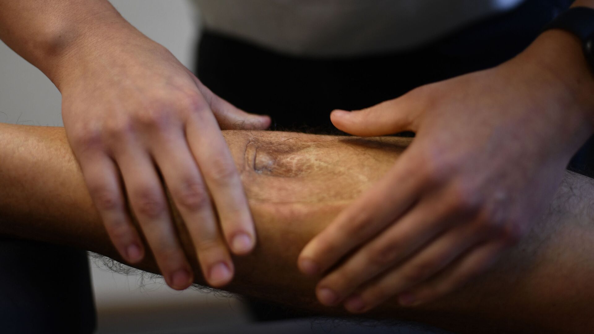 ساق شخص مريض يتم معالجته عن طريق التدليك - سبوتنيك عربي, 1920, 15.09.2021