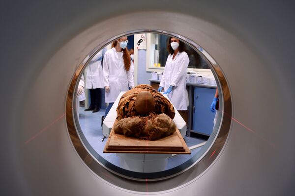 المومياء المصرية  تخضع للأشعة المقطعية في مشفى ميلانو، إيطاليا 21 يونيو 2021 - سبوتنيك عربي