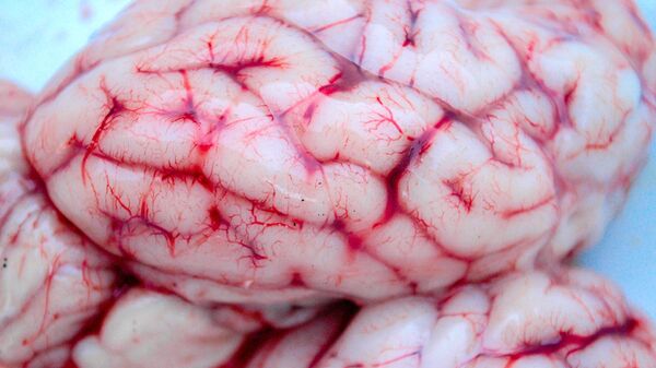 جزء من دماغ بشري في المختبرات العلمية  - سبوتنيك عربي