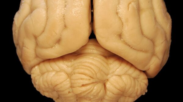 نموذج دماغ بشري في المختبر  - سبوتنيك عربي
