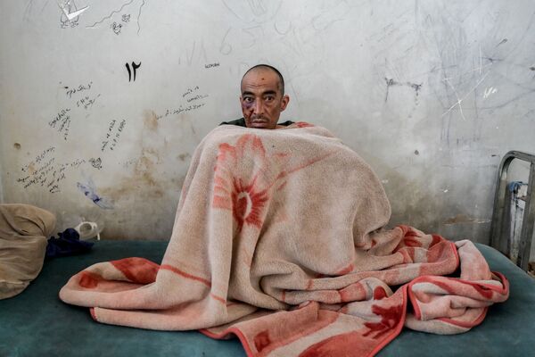 مدمن مخدرات يجلس على سريره في جناح إزالة السموم في مستشفى ابن سينا الطبي للعلاج من تعاطي المخدرات في كابول، أفغانستان 10 أكتوبر 2021 - سبوتنيك عربي