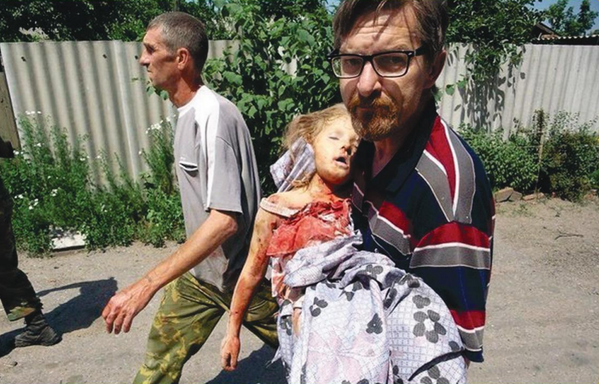 8 يونيو/ تموز 2014. فتاة تبلغ من العمر خمس سنوات تتعرض لقصف في قرية سيميونوفكا. - سبوتنيك عربي