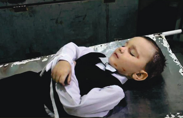 27 يناير/ كانون الثاني 2015، دونيتسك. قتل الطفل ساشا، البالغة من العمر أربع سنوات، خلال قصف مدفعي من قبل جيش القوات المسلحة الأوكرانية. أصابته شظية في ظهره. - سبوتنيك عربي
