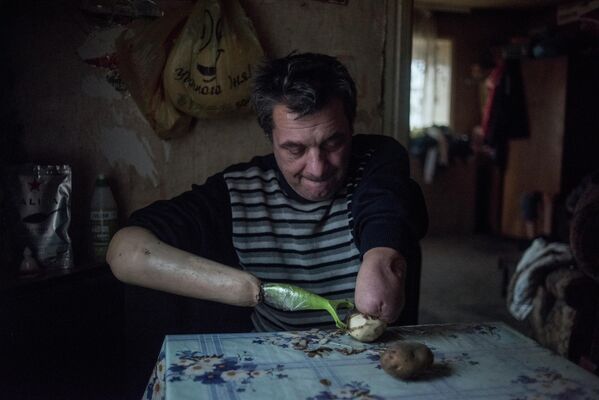 يوري يانوش، 51 عامًا، فقد ذراعيه قبل الحرب، يقوم بتقشير البطاطا. يعيش في قرية غورتي بالقرب من دونيتسك. المعوقون الوحيدون لا يأملون ولا يعتمدون على أحد، ولا يمكنهم الحصول على رعاية طبية عادية، ولا يوجد عمل. القصف المنتظم هو الواقع الذي يُجبر فيه الأشخاص على الحياة رغم صعوبتها في الحرب. - سبوتنيك عربي