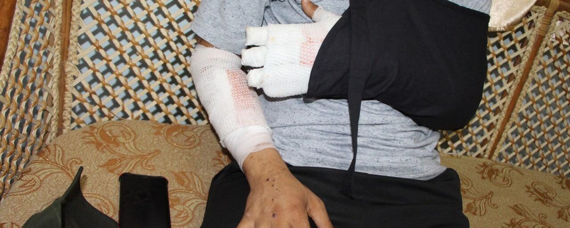 إصابات المواطن صخر وأشقائه جراء قصف أغسطس/ آب 2022 في غزة   - سبوتنيك عربي, 1920, 23.08.2022