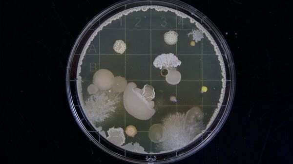 أحد أصناف البكتيريا داخل وعاء خاص - سبوتنيك عربي