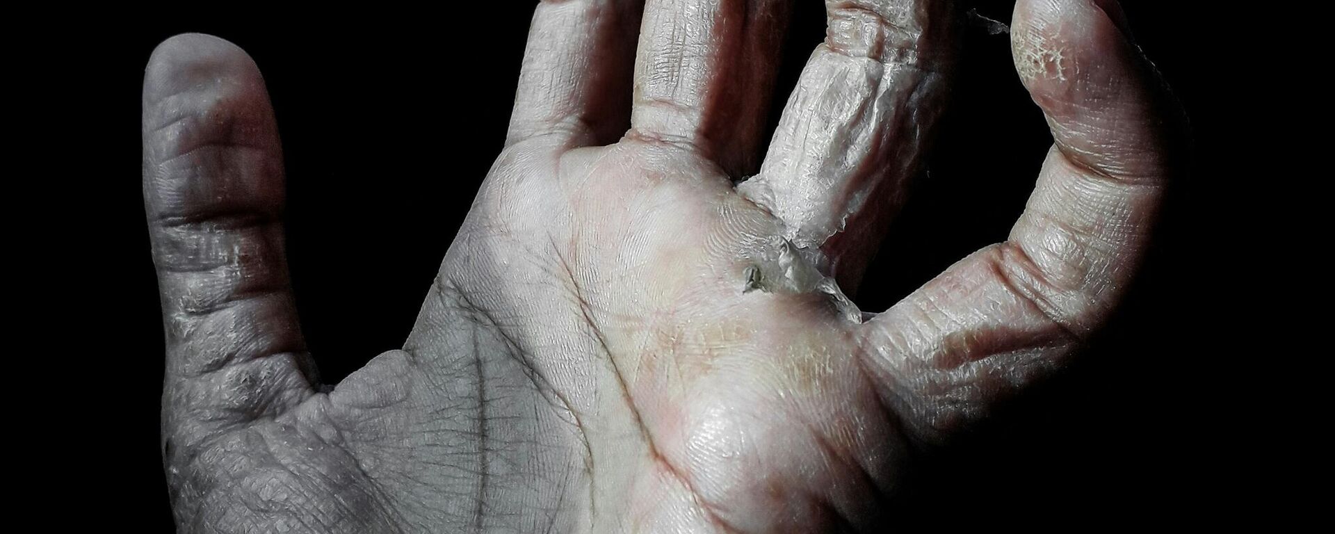 يد مكسورة يد مكسورة - وطن نيوز العربية، 1920، 16.02.2024