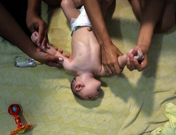 طبيب عام يفحص طفلا برازيليا مصابا بمرض صغر الرأس، البرازيل 26 مارس/ آذار 2016. - سبوتنيك عربي