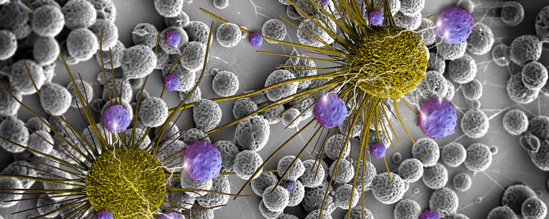 Cancer cells - سبوتنيك عربي, 1920, 08.02.2017