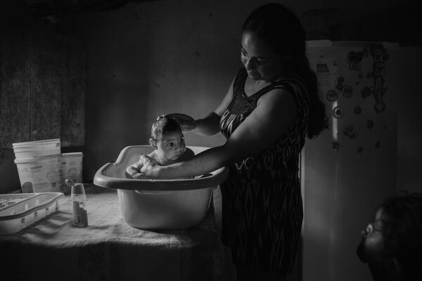 جائزة صورة الصحافة العالمية لعام 2017 (World Press Photo 2017) - فئة مشاكل العصر - اسم الصورة ضحايا فيروس زيكا  (Victims of the Zika Virus) - المرتبة الثانية للمصورلالو دي ألميدي - سبوتنيك عربي