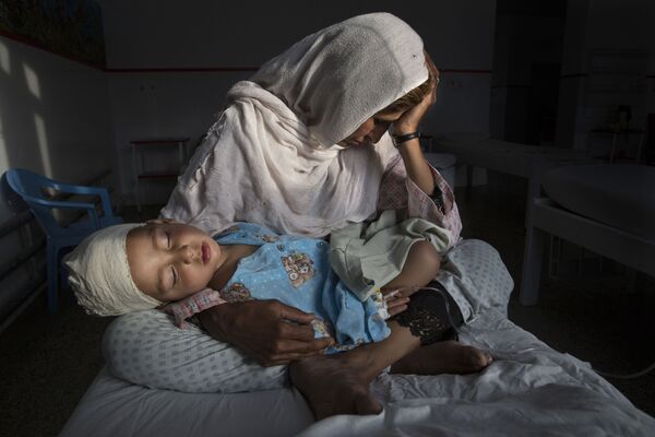جائزة صورة الصحافة العالمية لعام 2017 (World Press Photo 2017) فئة الحياة اليومية - اسم الصورة الضحايا الصامتون في حرب منسية - المرتبة الأولى للمصور باولا برونستين - سبوتنيك عربي