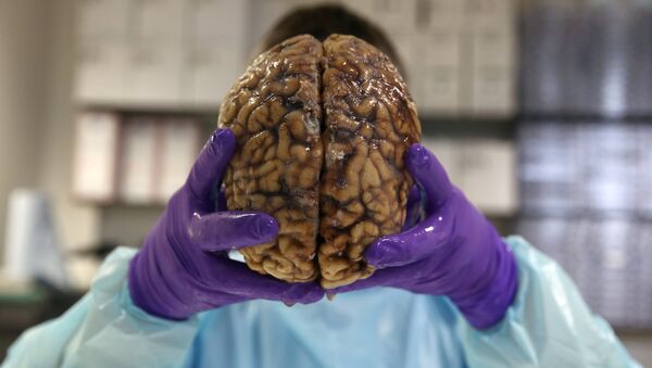 دماغ بشري - سبوتنيك عربي