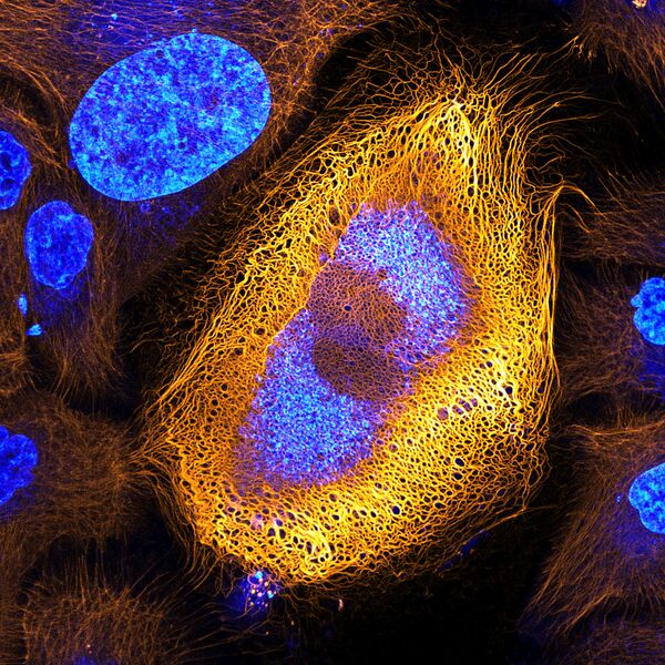 صورة من خلايا الجلد البشري، والصورة مكبرة 40 مرة- حائزة على المرتبة الأولى، هولندا - سبوتنيك عربي