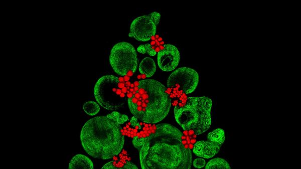 صورة لزراعة أنسجة غضروفية في مختبر باستخدام خلايا جذعية عظمية، والصورة مكبرة 20 و40 مرة - حائزة على المرتبة الـ 9، المملكة المتحدة - سبوتنيك عربي
