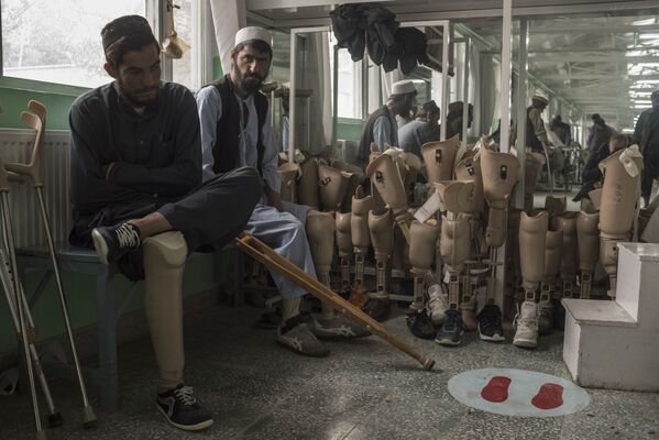 عيادة طب العظام في كابول، أفغانستان - سبوتنيك عربي
