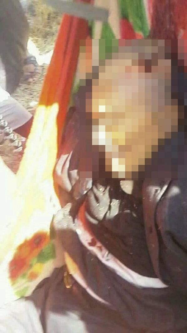 الصور الأولى لمقتل الرئيس اليمني السابق علي عبدالله صالح الصور الأولى لمقتل الرئيس اليمني السابق علي عبدالله صالح - سبوتنيك عربي