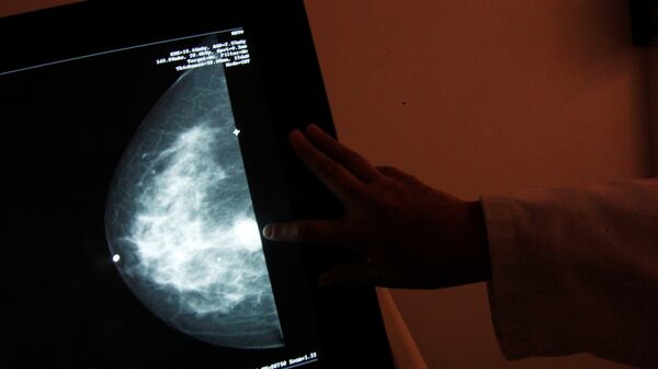 سرطان الثدي - سبوتنيك عربي