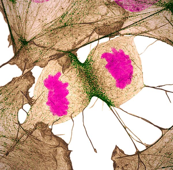 صورة تقسيم الخلايا الليفية للحمض النووي للإنسان، للمصور الدكتور دايلان برونيت ونيلاي تانيجا، الحائزة على المرتبة الـ11  في المسابقة - سبوتنيك عربي