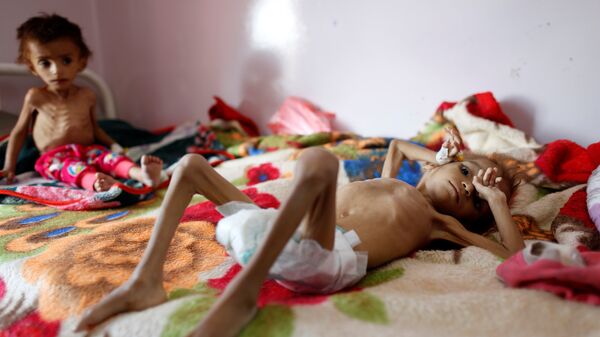 أطفال اليمن، المجاعة، 6 أكتوبر/ تشرين الأول 2018 - سبوتنيك عربي