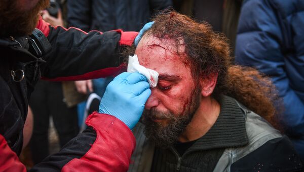إصابة كوستيس دادميس مراسل سبوتنيك أثناء الاحتجاجات في أثينا - سبوتنيك عربي
