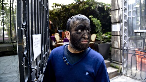 الرجل المكسيكي خيسوس أسيفيس، المعروف باسم الرجل الذئب، لفرط نمو الشعر على الوجه، 2015 - سبوتنيك عربي