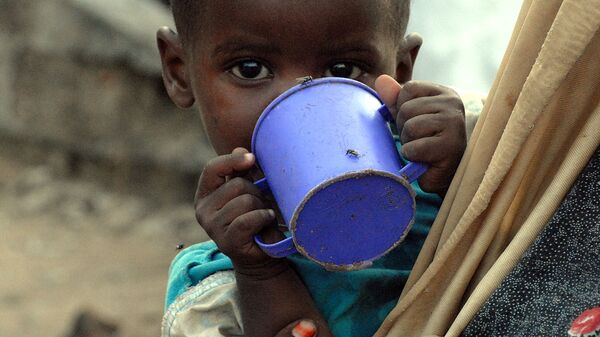 طفل نازح  في الصومال يعاني من سوء تغذية - سبوتنيك عربي