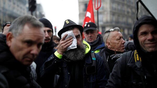 جيروم رودريغز أحد الشخصيات البارزة في حركة السترات الصفراء يقوم بوضع كيس ثلج على عينه بعد إصابته خلال مظاهرة بعد 24 يومًا من الإضراب ضد خطط إصلاح معاشات الحكومة الفرنسية في باريس - سبوتنيك عربي