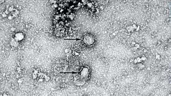 فيروس كورونا تحت المجهر - سبوتنيك عربي
