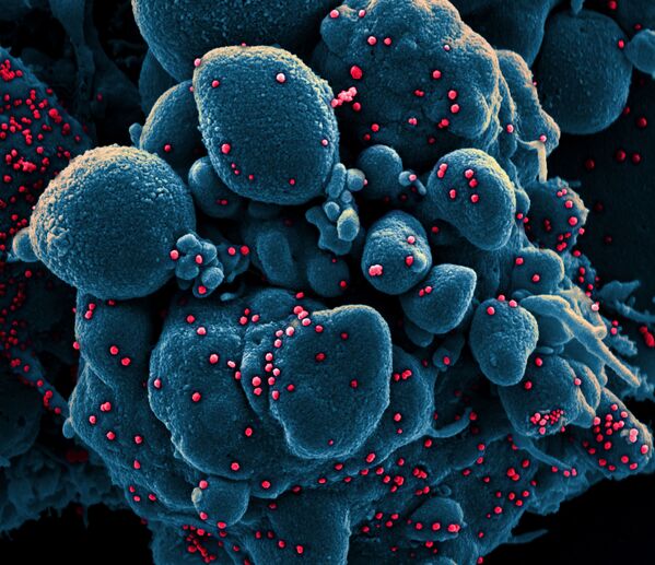 مسح إلكتروني مصغر لخلية في حالة استماتة (باللون الأزرق) مصابة بجزيئات من الفيروس SARS-COV-2 (باللون الأحمر)، والمعروفة أيضًا باسم كورونا، تم أخذها كعينة من مريض. تم التقاط الصورة في مركز للأبحاث في فورت ديتريك بولاية ماريلاند الأمريكية. - سبوتنيك عربي