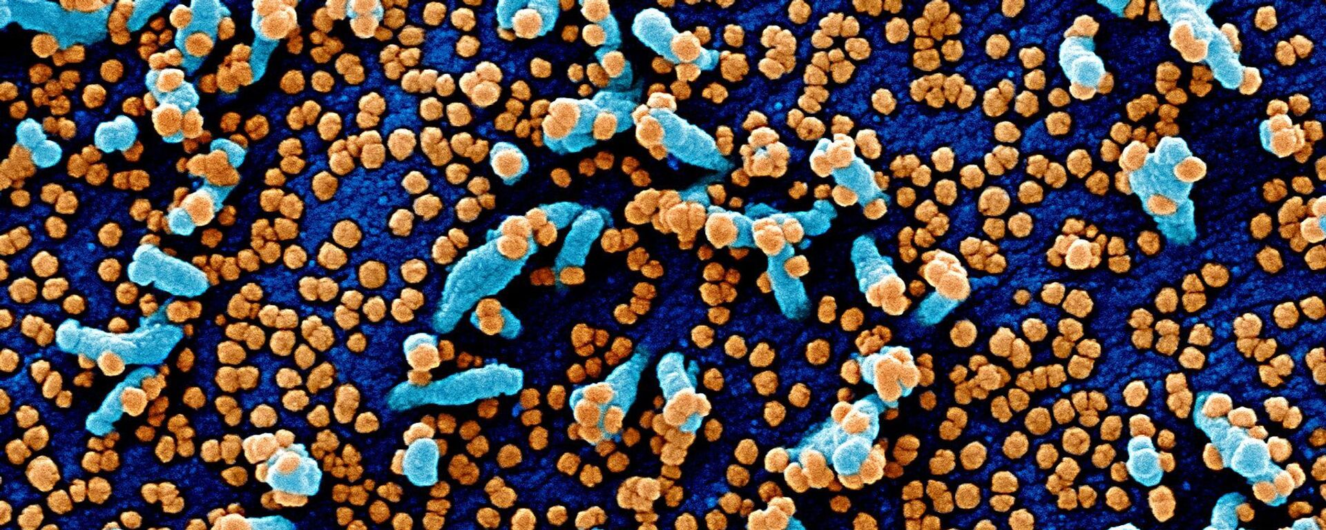 مسح إلكتروني مصغر لخلية فيرو (خلايا توجد في الكلى، باللون الأزرق) مصابة بجزيئات من الفيروس SARS-COV-2 (باللون البرتقالي)، والمعروفة أيضًا باسم كورونا، تم أخذها كعينة من مريض. تم التقاط الصورة في مركز للأبحاث في فورت ديتريك بولاية ماريلاند الأمريكية. - سبوتنيك عربي, 1920, 20.04.2023