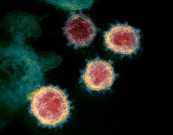 تُظهر صورة المجهر الإلكتروني لفيروس SARS-CoV-2، والمعروف أيضًا باسم الفيروس التاجي الجديد كورونا، الذي يسبب مرض فيروسي COVID-19، المعزول من مريض في الولايات المتحدة. وتظهر على الخلايا نتوءات صغيرة خارج سطح الخلايا فتبدو كتاج. - سبوتنيك عربي