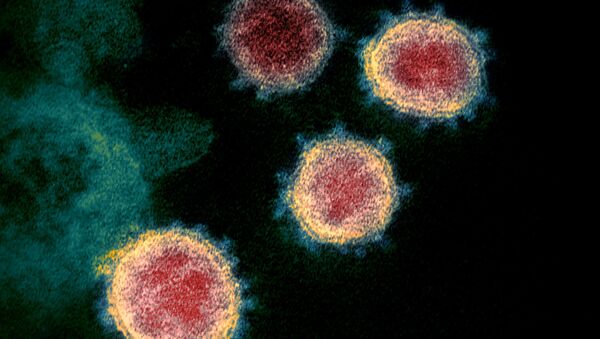 تُظهر صورة المجهر الإلكتروني لفيروس SARS-CoV-2، والمعروف أيضًا باسم الفيروس التاجي الجديد كورونا، الذي يسبب مرض فيروسي COVID-19، المعزول من مريض في الولايات المتحدة. وتظهر على الخلايا نتوءات صغيرة خارج سطح الخلايا فتبدو كتاج. - سبوتنيك عربي