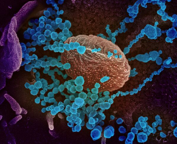 تُظهر صورة المجهر الإلكتروني (الأجسام الزرقاء المستديرة)، والمعروفة أيضًا باسم الفيروس التاجي الجديد SARS-CoV-2، الفيروس الذي يسبب مرض COVID-19. - سبوتنيك عربي