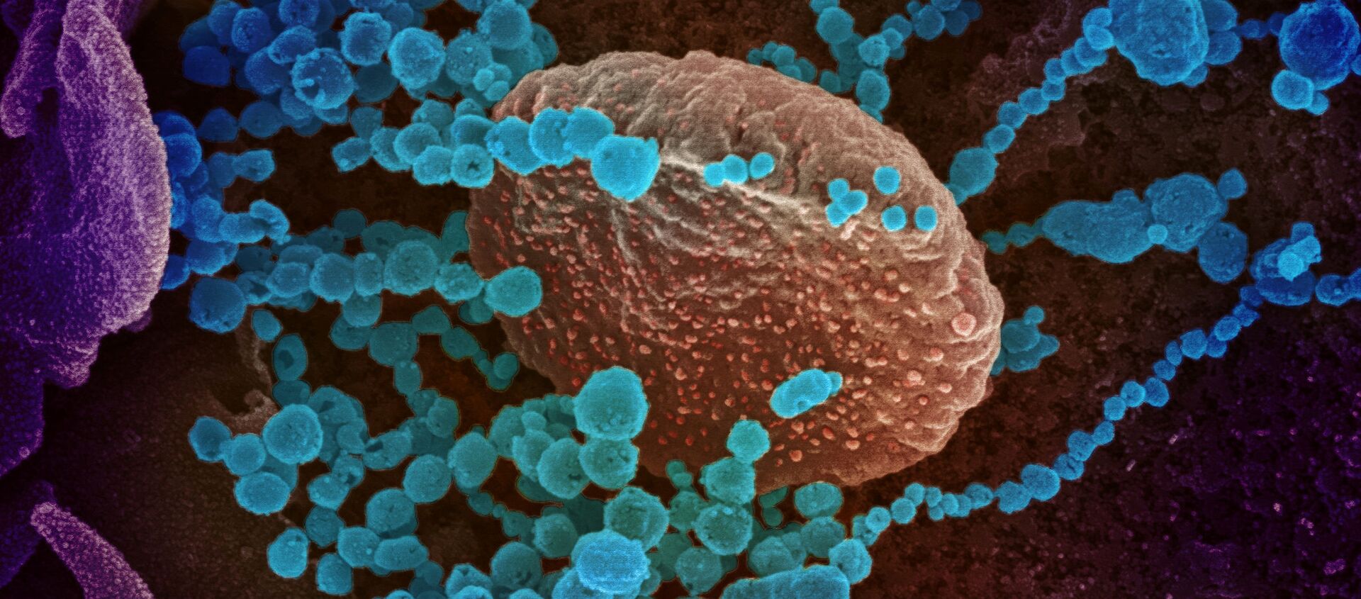 تُظهر صورة المجهر الإلكتروني (الأجسام الزرقاء المستديرة)، والمعروفة أيضًا باسم الفيروس التاجي الجديد SARS-CoV-2، الفيروس الذي يسبب مرض COVID-19. - سبوتنيك عربي, 1920, 30.08.2021