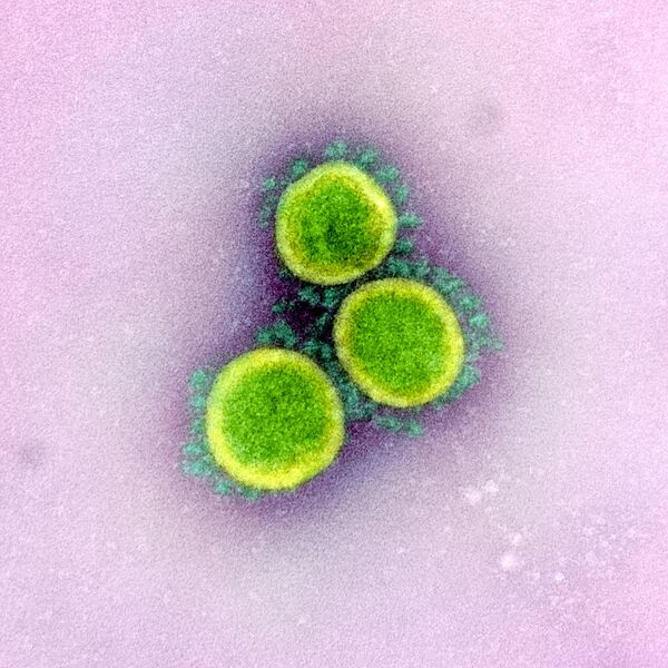 تُظهر صورة المجهر الإلكتروني جزيئات، والمعروفة أيضًا باسم الفيروس التاجي الجديد SARS-CoV-2، الفيروس الذي يسبب مرض COVID-19. - سبوتنيك عربي