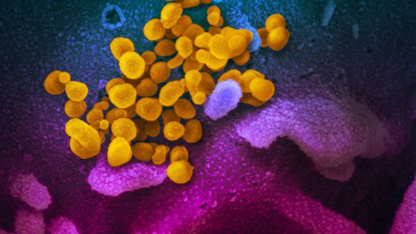 صورة مجهرية إلكترونية لعينة من مريض، لجزيئات فيروس SARS-COV-2 (باللون الأصفر)، والمعروفة أيضًا باسم الفيروس التاجي الجديد كورونا، الفيروس الذي يسبب مرض Covid-19. - سبوتنيك عربي