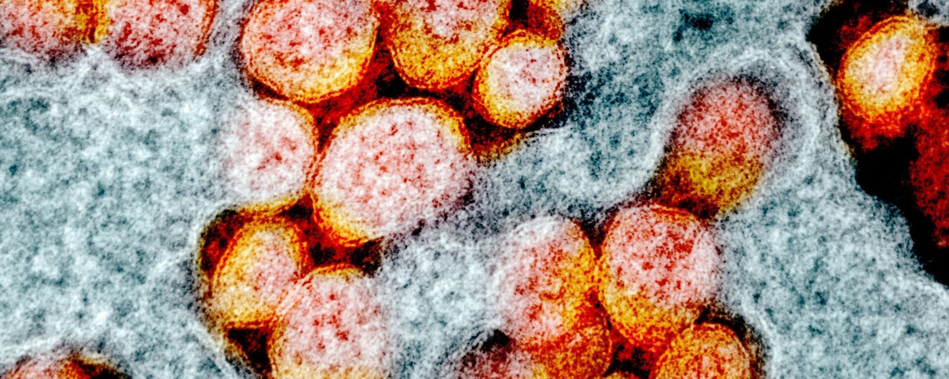 صورة مجهرية إلكترونية لعينة من مريض، لجزيئات فيروس SARS-COV-2، والمعروفة أيضًا باسم الفيروس التاجي الجديد كورونا، الفيروس الذي يسبب مرض Covid-19. - سبوتنيك عربي, 1920, 25.10.2021