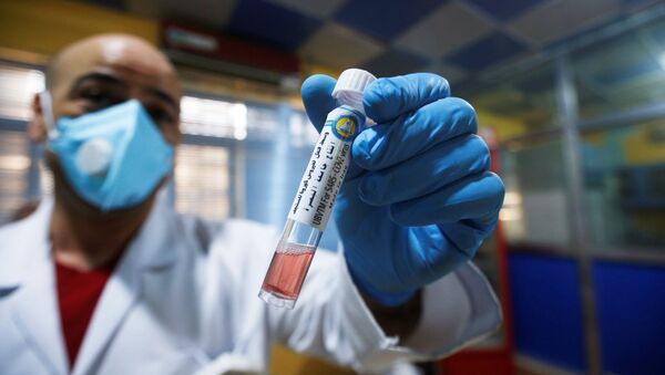 طبيب عراقي يعرض مكون اختبار محلي لمرض فيروس كورونا أنتجته مجموعة من الباحثين من جامعة البصرة  - سبوتنيك عربي