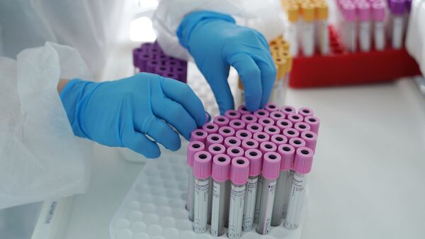 أنابيب اختبار لجمع المواد الحيوية في مركز الدم - سبوتنيك عربي